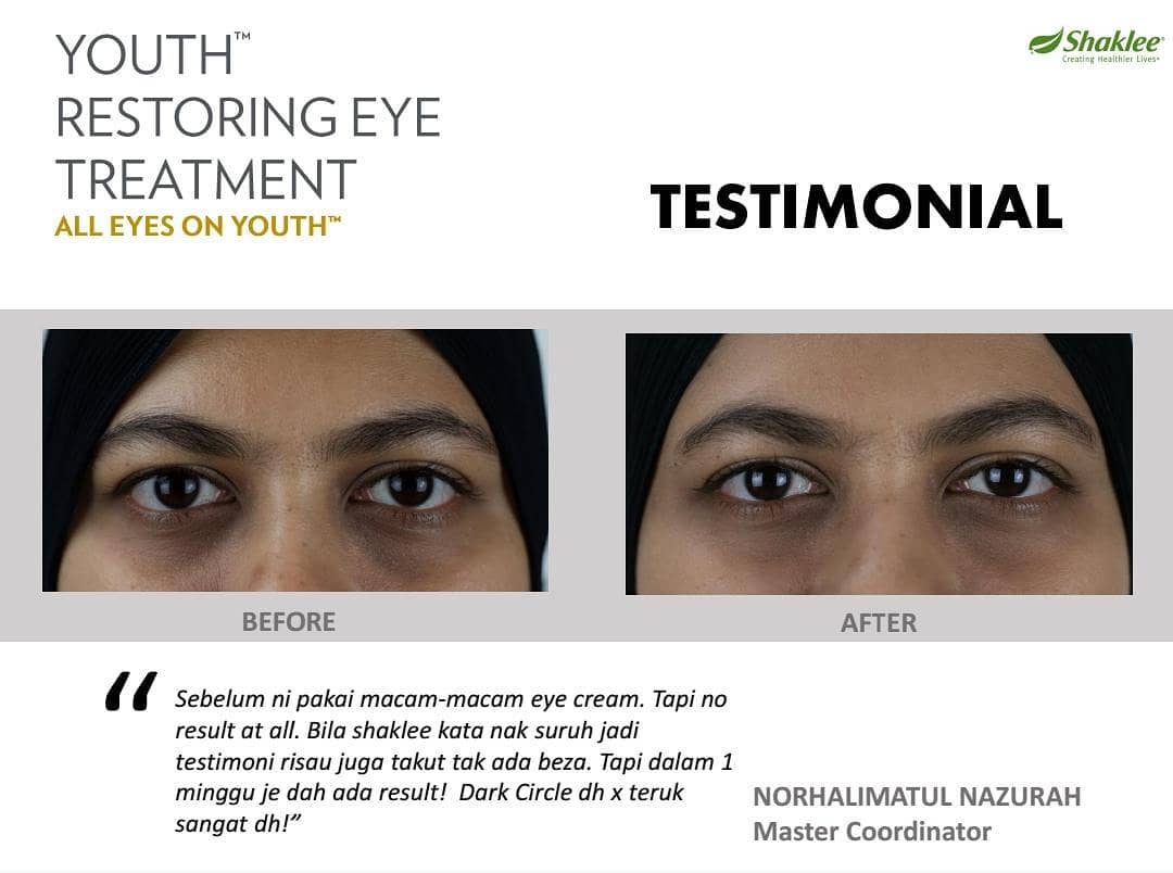 Eye Treatment Youth Shaklee Untuk Mata Lebam Dark Circle Eye Bag