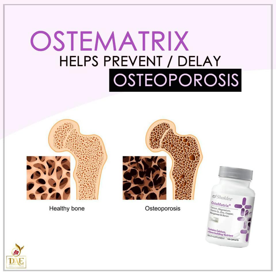 ostematrix osteoporosis prevention delay
