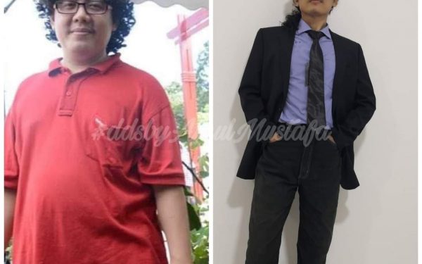 Badan Menggelebeh Selepas Turun Berat: Punca & Cara Tegangkan Kulit Secara Semula Jadi
