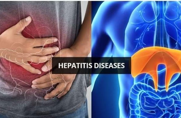 Hepatitis Penyakit Keradangan Hati