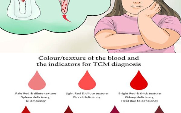 Warna Darah Haid Mendedahkan Kesihatan Wanita ?