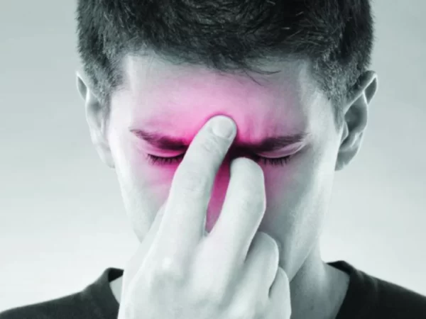 Sinus Resdung Sembuh Dengan ResV