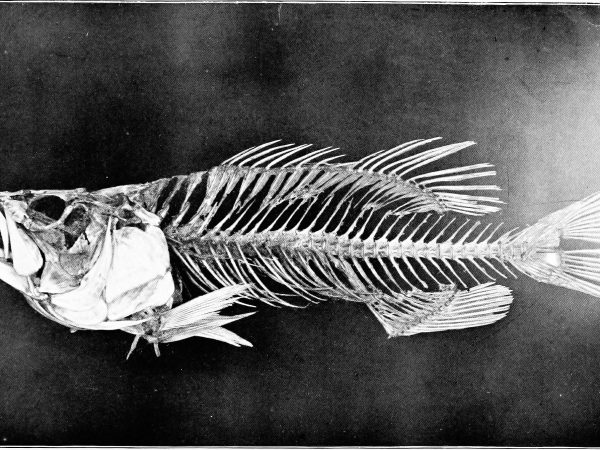 Tertelan Tulang Ikan Punca Usus Bocor?