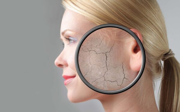 Kulit Kering Tak Hilang Walaupun Dah Pakai Lotion? Ini Punca Sebenar & Cara Rawat Dari Dalam