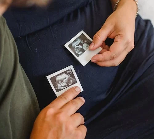 Berjaya Hamil Selepas 10tahun Dengan Vivix ResV