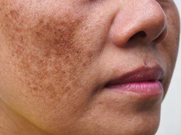 Jeragat Hilang 2 Minggu Amalkan ResV Vivix