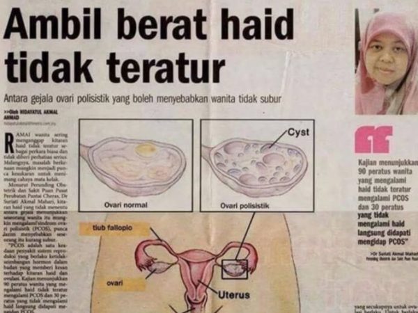 Haid Tidak Teratur : Supplement Bantu lancarkan Haid, Mudah hamil