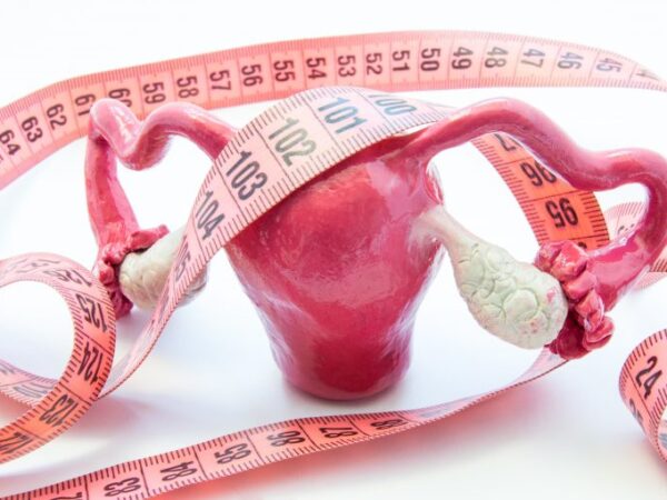 Fibroid 10cm Mengecil ke 4cm Dengan Vivix