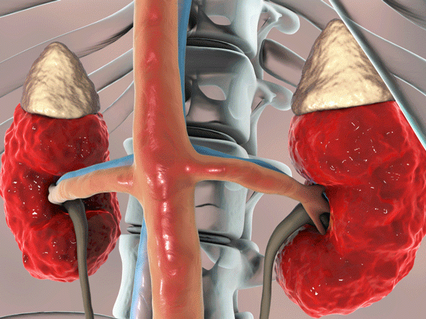 Buah Pinggang Bocor Sembuh