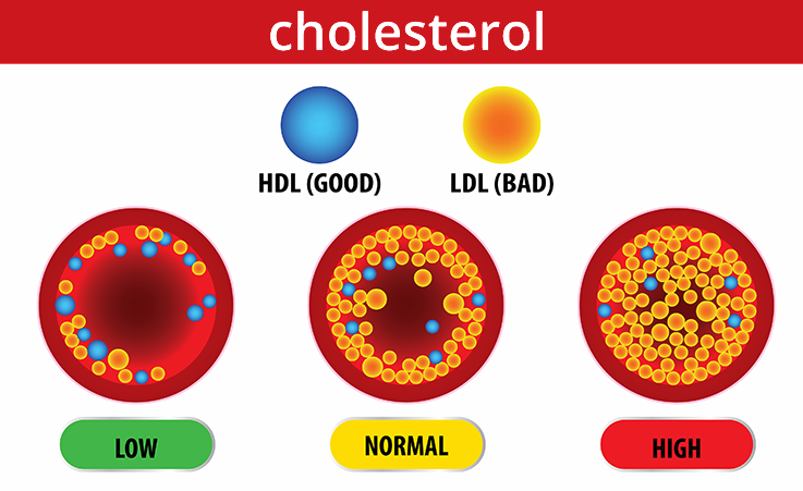 Turunkan Kolesterol Tanpa Ubat