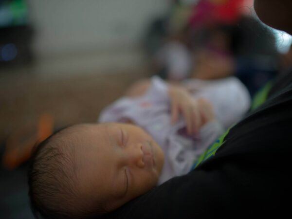 Cara Hilangkan Kuning Bayi