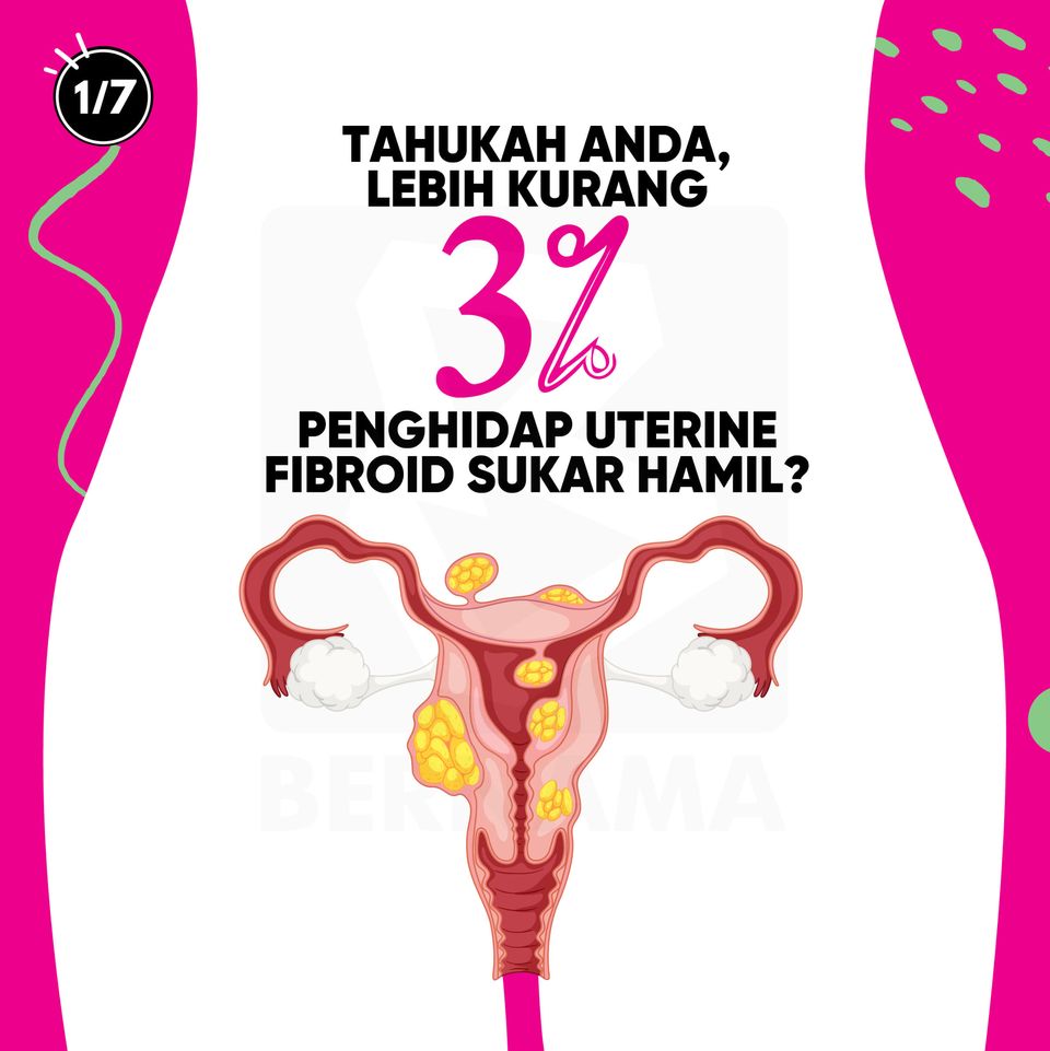 ubat kecutkan fibroid
