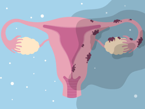 Endometriosis Berjaya Hamil Dengan Shaklee