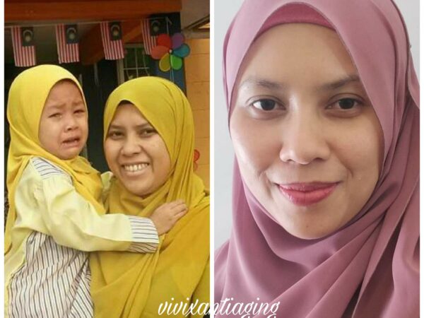 ESP Shaklee Untuk Kulit