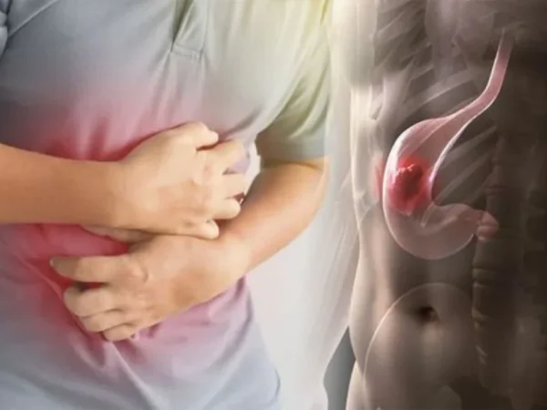 Gastrik Sembuh Dengan ESP