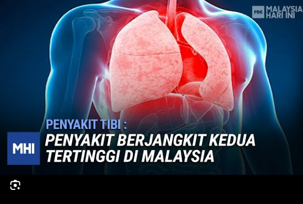 Petua Hilangkan Penyakit Tibi