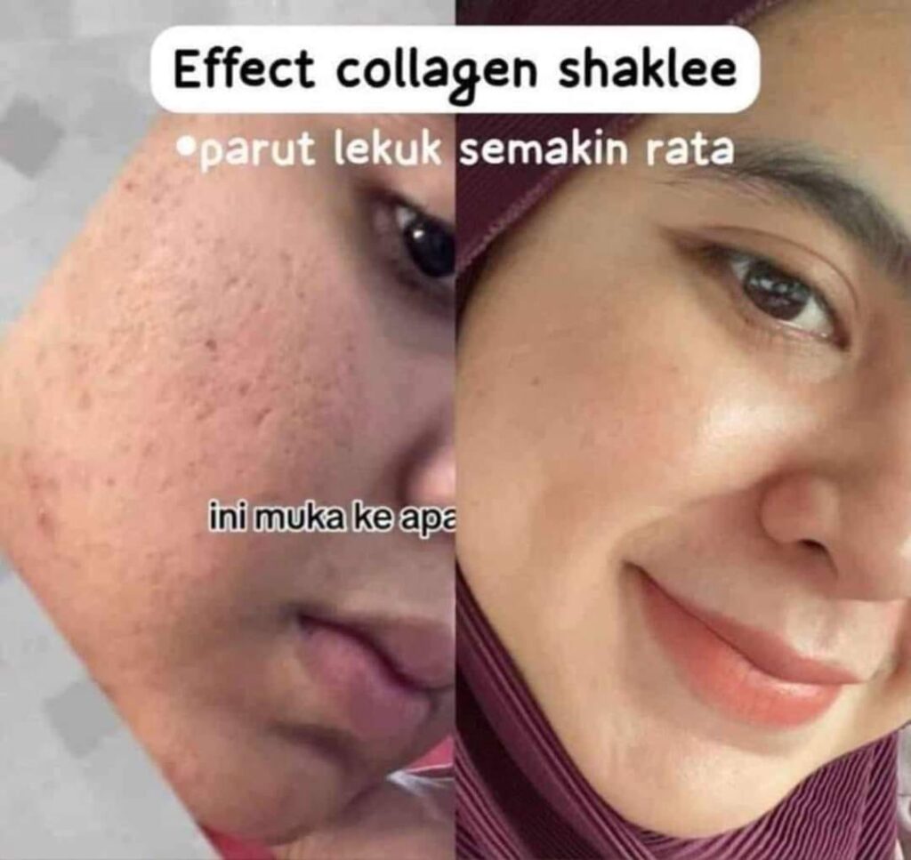 Collagen Shaklee 