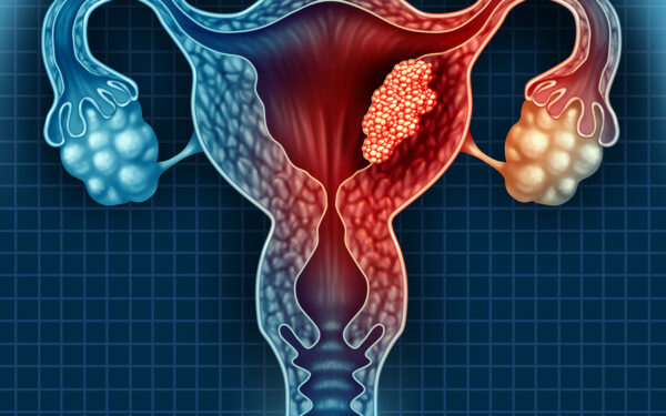 Fibroid Ketika Mengandung Berjaya Kecut Sendiri