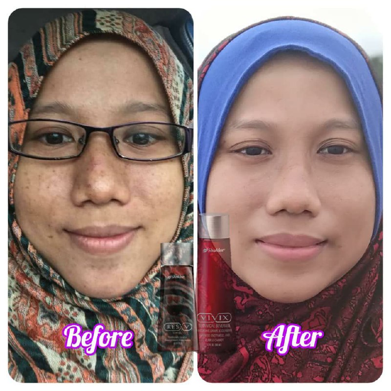 Vivix Bantu Jeragat Pudar