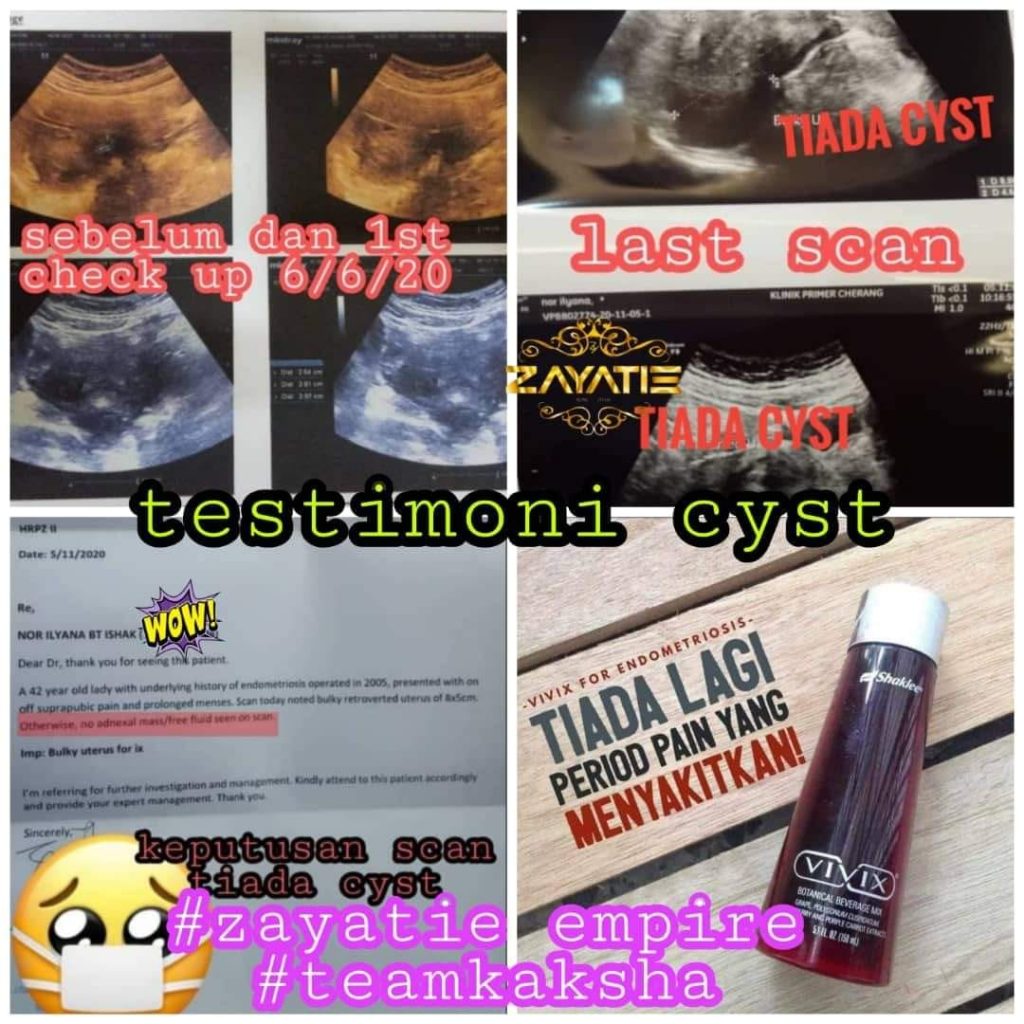 Vivix Shaklee Untuk Endometriosis