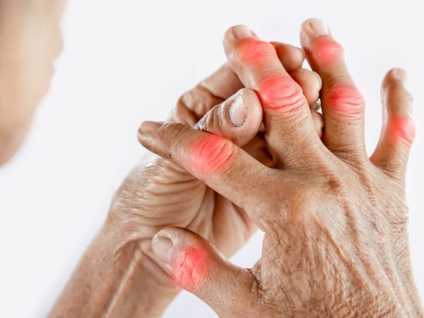 Supplement Untuk Rheumatoid Arthritis: Cara Kurangkan Sakit & Radang Secara Semulajadi