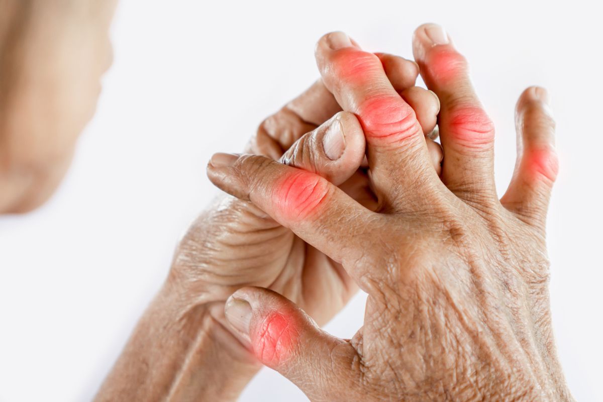 Supplement Untuk Rheumatoid Arthritis: Cara Kurangkan Sakit & Radang Secara Semulajadi