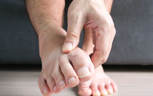 Cara Redakan Gout Dengan Cepat Secara Semulajadi