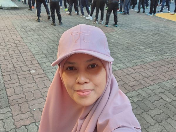 Tona Warna Tak Sekata: Punca, Cara Rawat & Tips Dapatkan Kulit Lebih Sekata Secara Semula Jadi