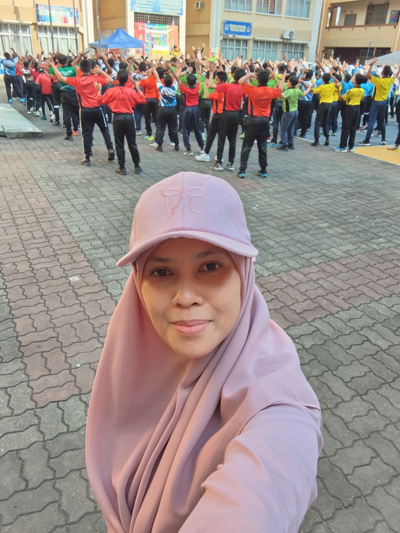 Tona Warna Tak Sekata: Punca, Cara Rawat & Tips Dapatkan Kulit Lebih Sekata Secara Semula Jadi