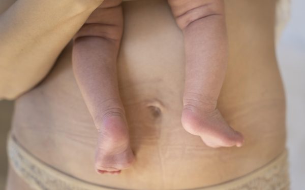 Luka Bersalin Lambat Kering: Punca, Tanda Bahaya & Cara Cepat Sembuh