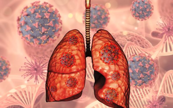 Jangkitan Paru-Paru: Punca, Tanda Bahaya dan Cara Cepat Pulih Secara Semulajadi