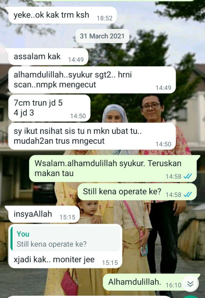 Cara Kecilkan Cyst Secara Semulajadi