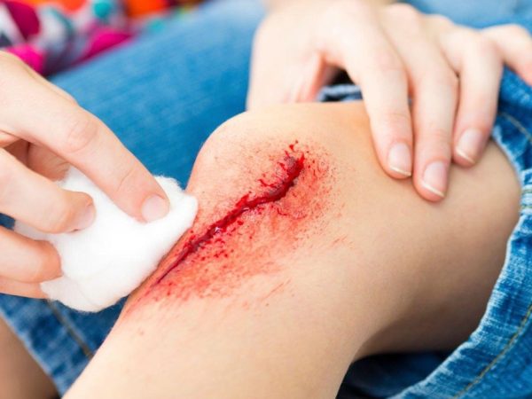 Vitamin Untuk Luka Cepat Sembuh