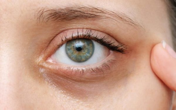 Vitamin Untuk Mata Letih: Cara Semula Jadi Mengurangkan Keletihan Mata