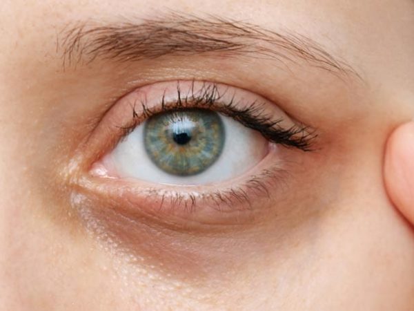 Vitamin Untuk Mata Letih: Cara Semula Jadi Mengurangkan Keletihan Mata