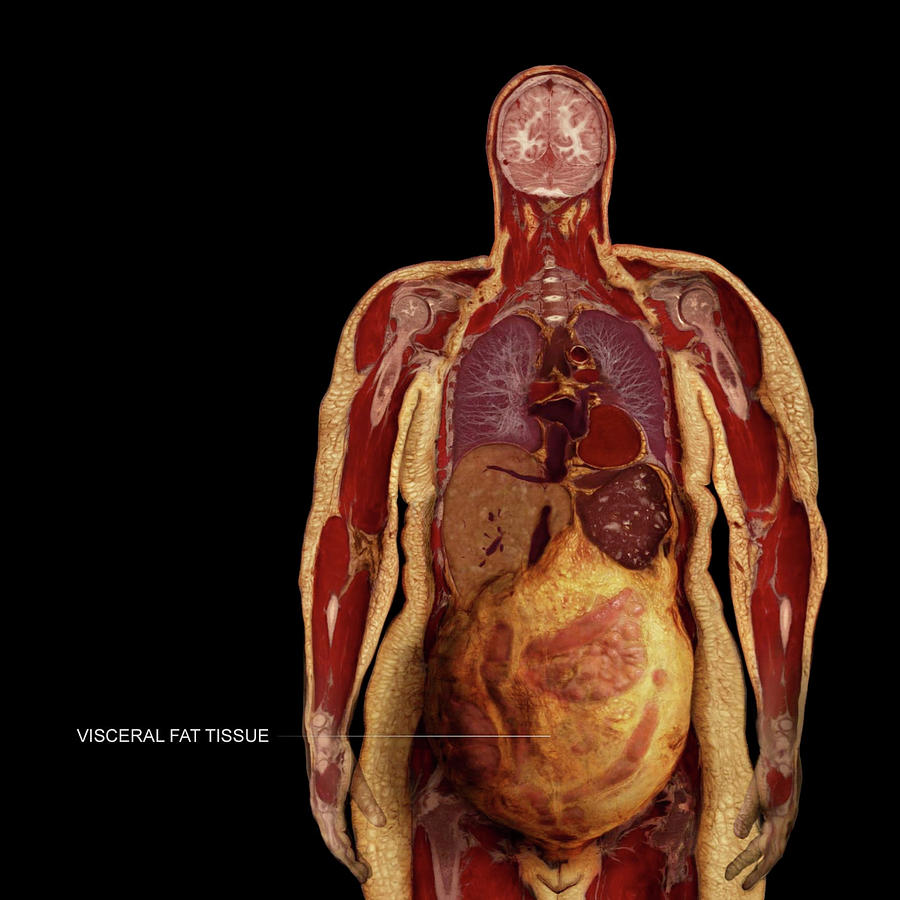 Turunkan Visceral Fat