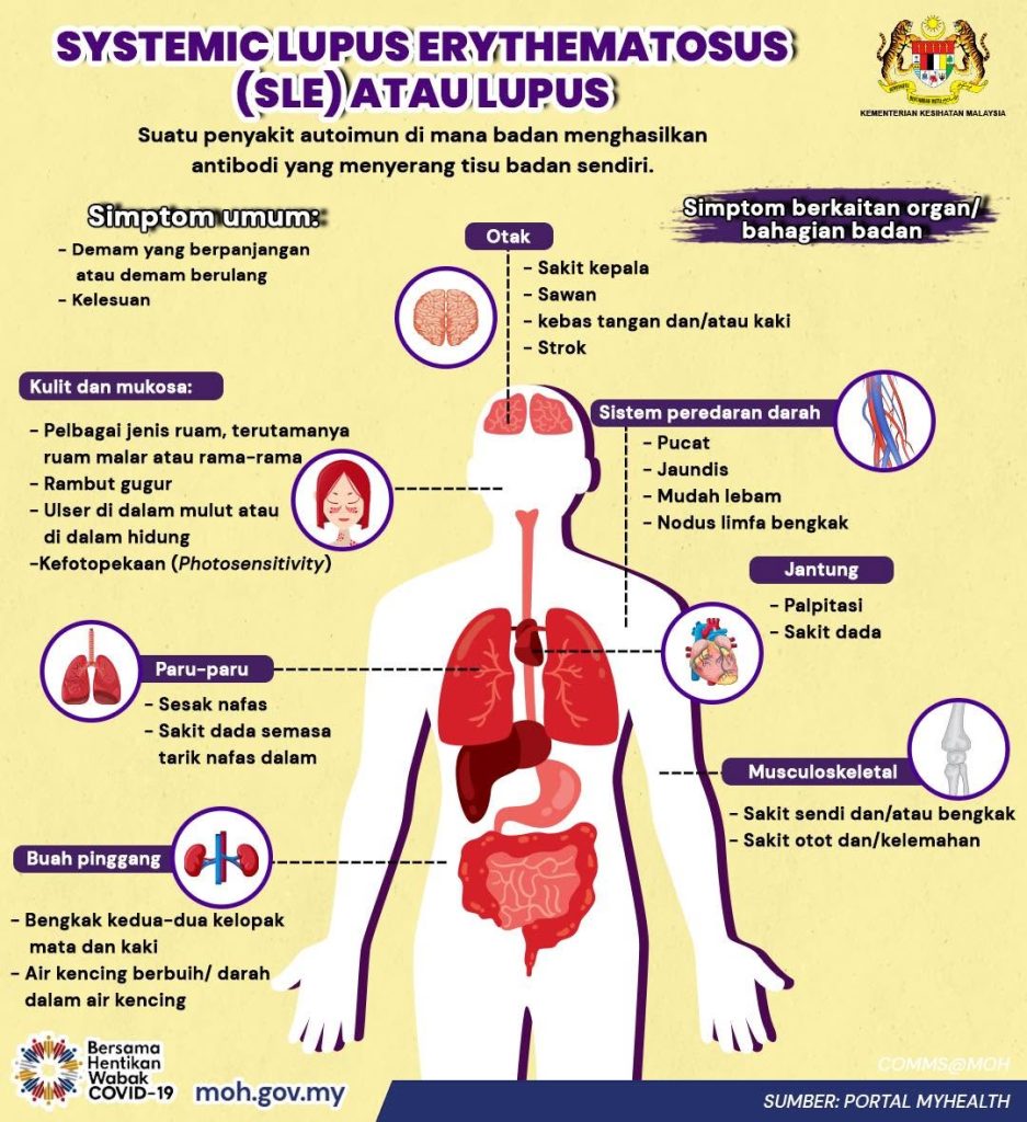 Suplemen Untuk Autoimmune