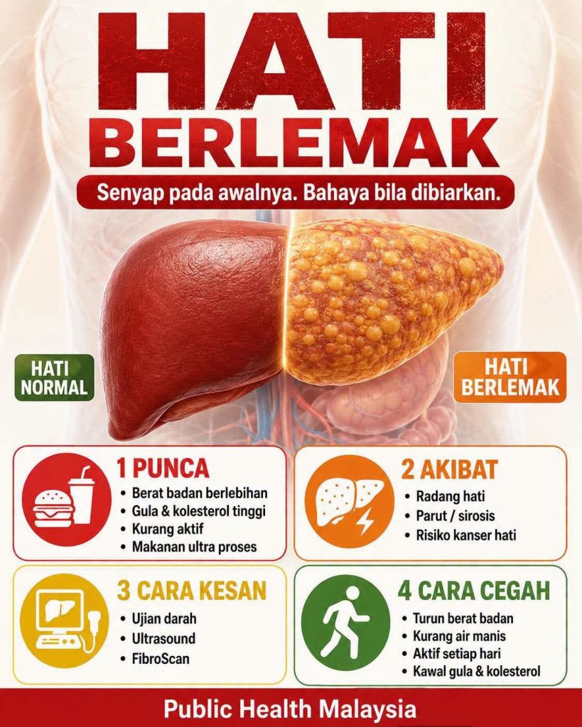 Hati Berlemak Wanita 40an