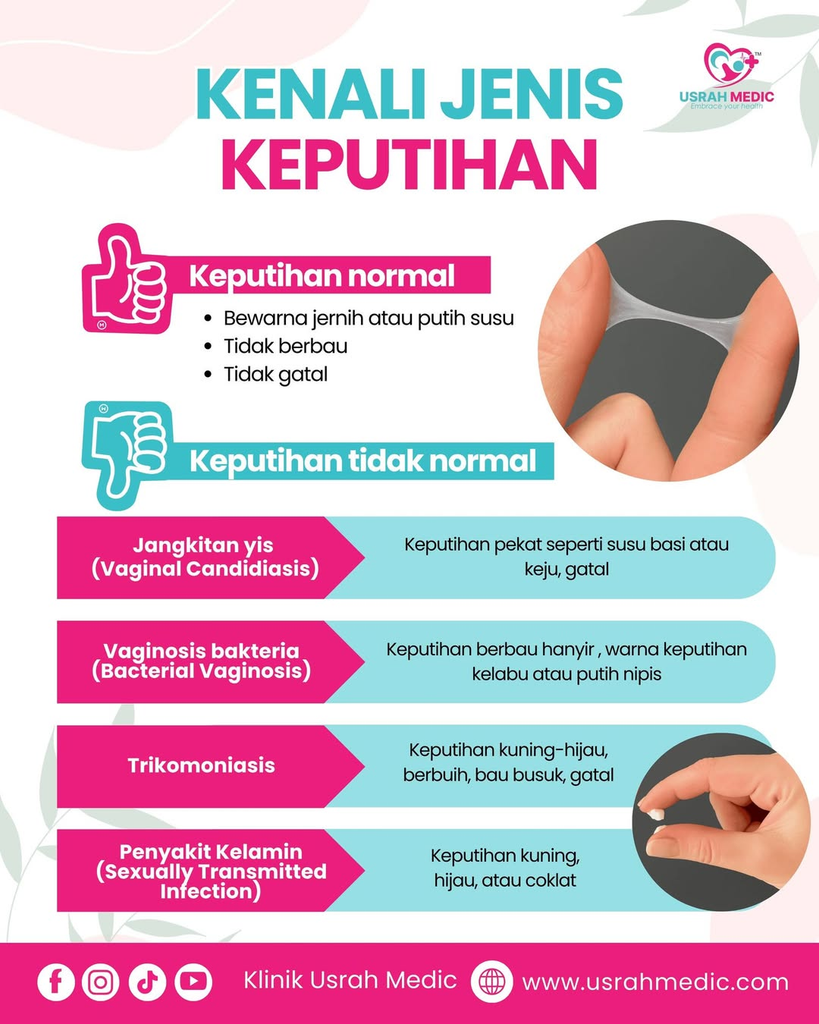 Keputihan Asyik Berulang