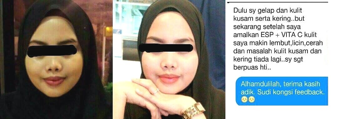 Supplement Untuk Kulit Kering