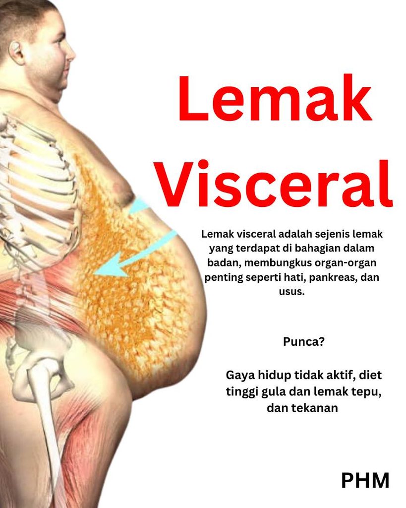 Kurus Tapi Perut Buncit?